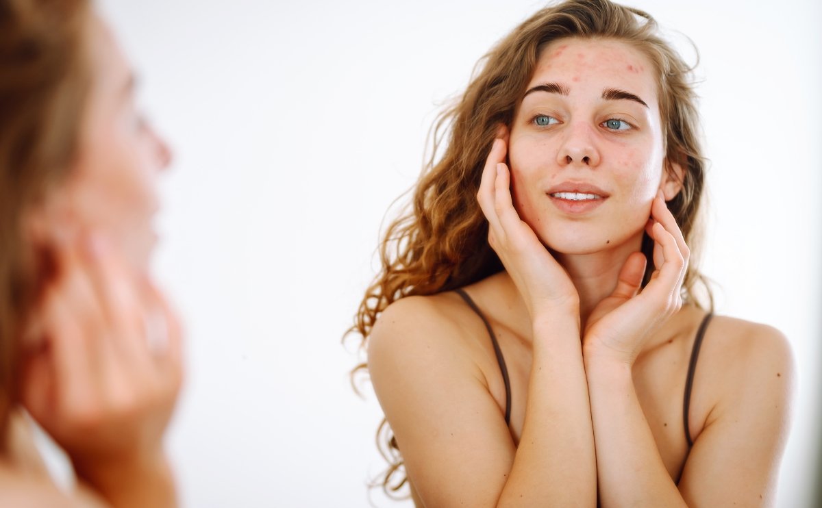 Cómo el Agua Puede Afectar Tu Piel